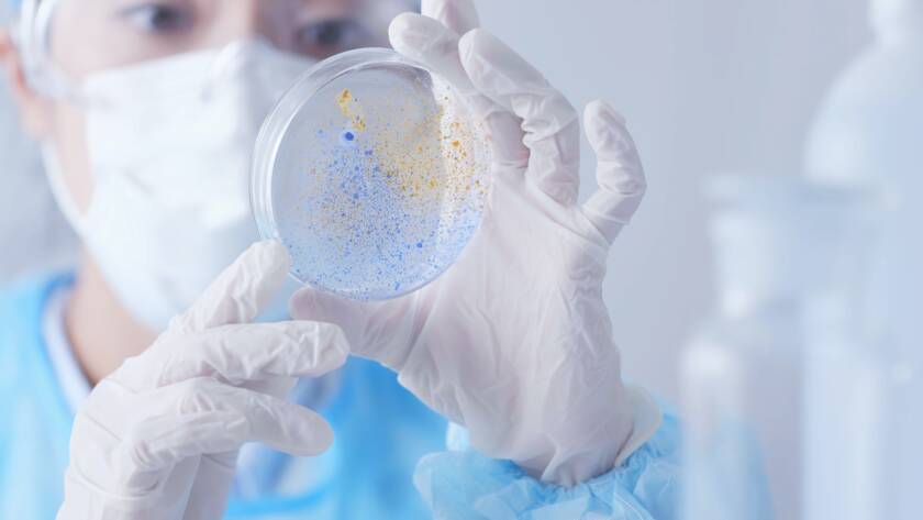 Scientist checking Petri dish